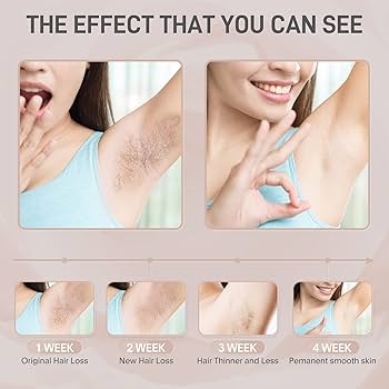 Permanent Hair Removal Serum